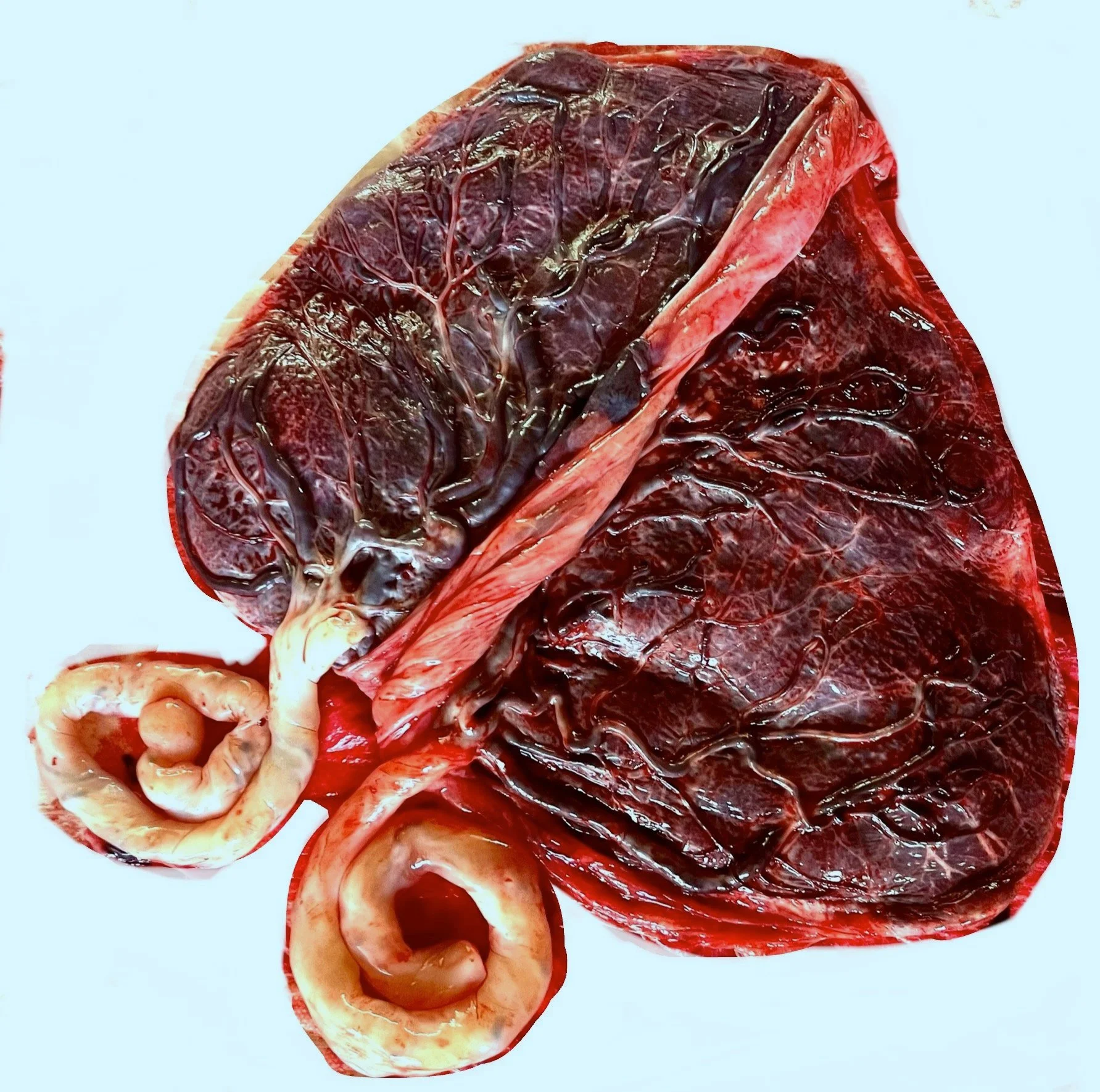 Aoki Birthing Care, LLC-Placenta